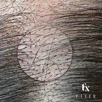 K.Kwong 獨家優惠 - FIXER 微點疑真空氣毛囊術 (SMP) - The Makeup Room
